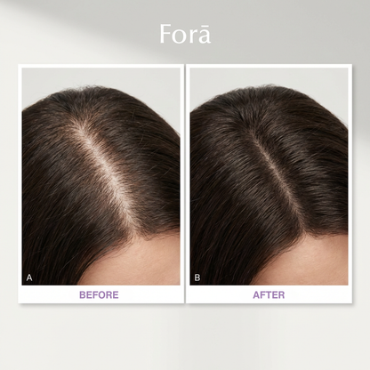 Precision Scalp Serum